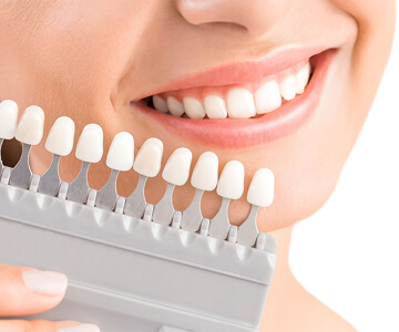 Teeth Whitening